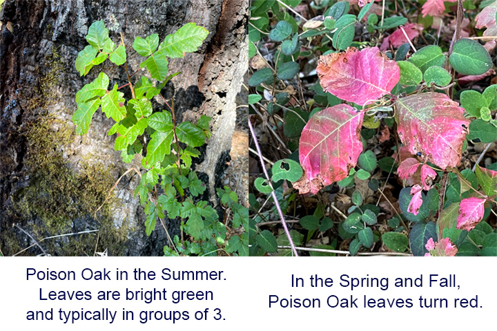 Clinical example of hypertrophic scar showing raised texture