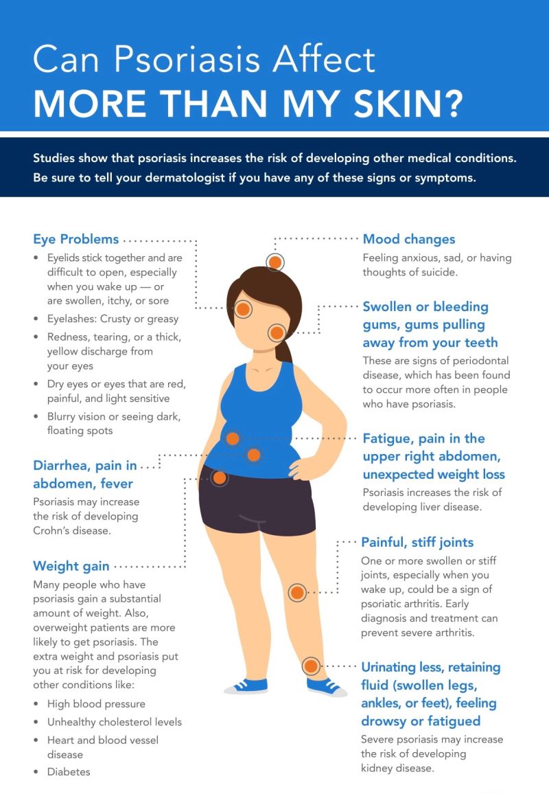 Can psoriasis affect more than my skin - systemic effects and comorbidities